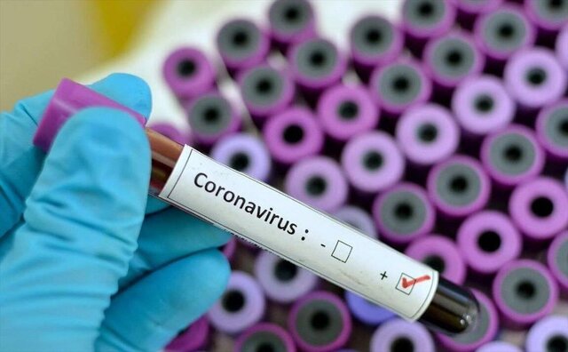 Iran to export coronavirus serology-based diagnostic kits