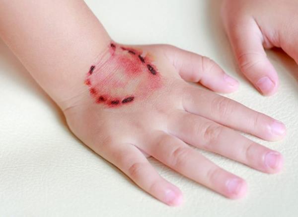 افزایش موارد مشکوک ابتلای گربه‌ها به هاری