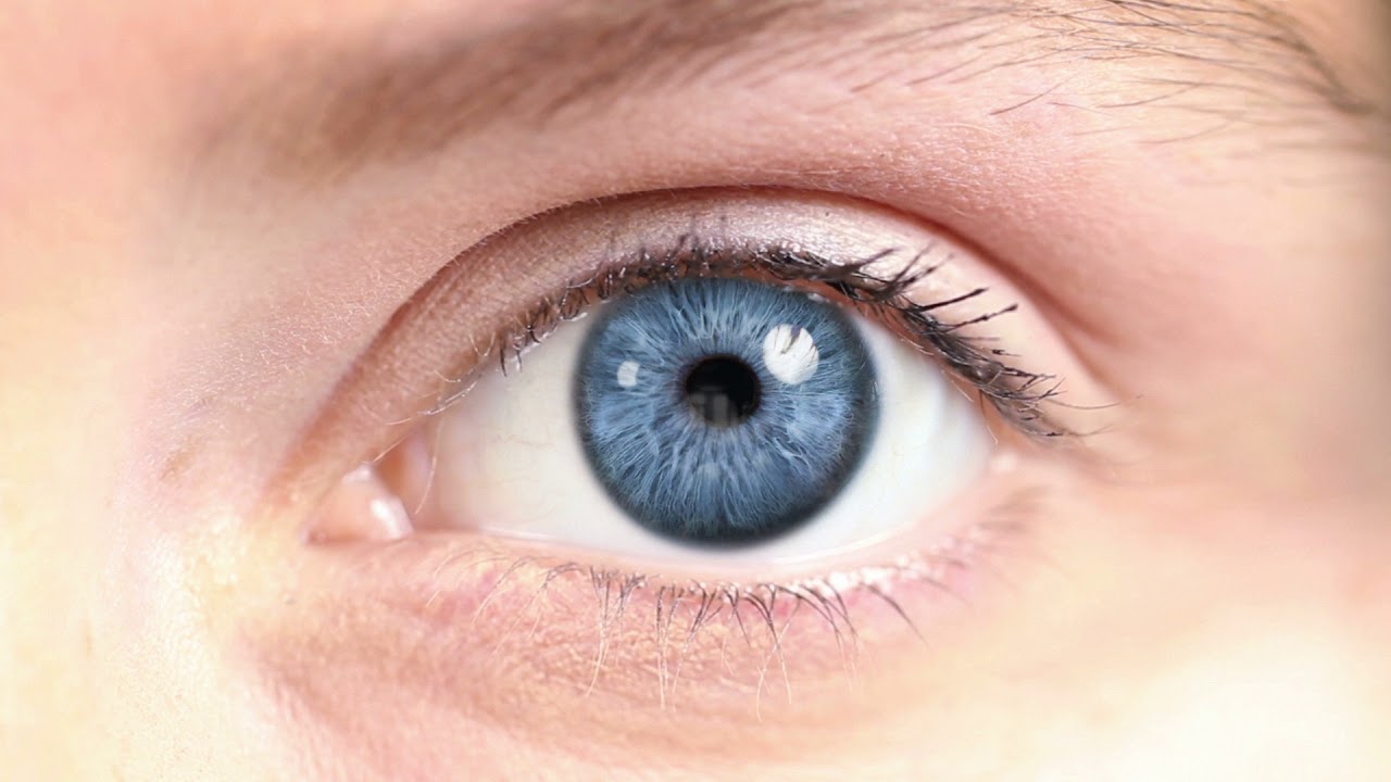 How to Get Rid of Dark Circles Permanently