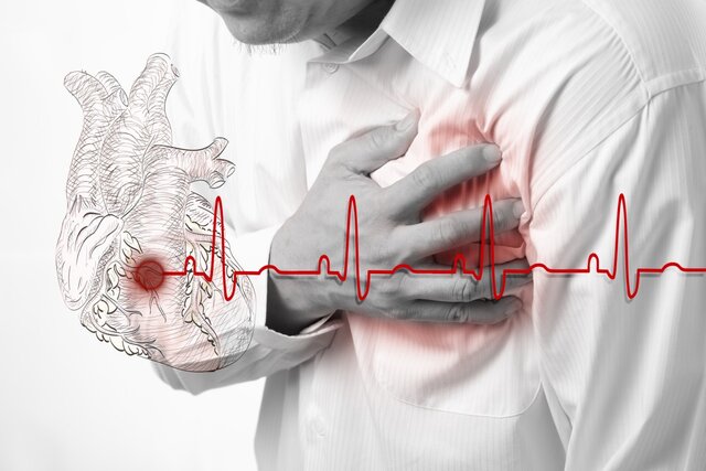 تشخیص حمله قلبی با هوش مصنوعی