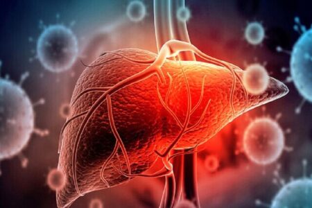 ۱۰ Home Remedies for Fatty Liver Disease