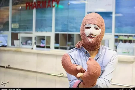 مرگ ۹۷ نفر بر اثر سوختگی در اصفهان