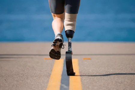 مبتکران اصفهانی کمک حال افراد دارای پای‌مصنوعی