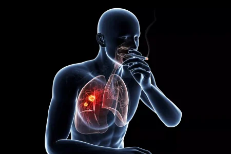 قاتلی با آمار ۸ میلیون نفر در سال